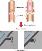 Venous valve-like micro check valve